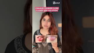 How to cure canker sore or chaale? | Nutshell shorts #158 | #shorts