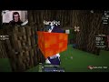 Restump detruit nardco en one piece uhc