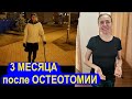 3 месяца после ОСТЕОТОМИИ: ПОХОДКА, ЗАРЯДКА, ОБРАЗ ЖИЗНИ, 90 ДНЕЙ на БОЛЬНИЧНОМ, что дальше?