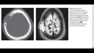 Brain Diagnostic imaging series book images (3)