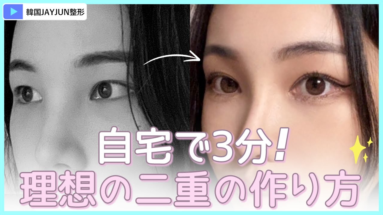 #二重 #二重手術 #二重ライン #二重作り 