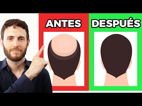 Video: ¿Cómo mantener el cabello bloqueado?