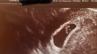 We’re expecting/I am pregnant!🤰🏻♥️🙏🏼! My first OB visit in Croatia!🩺👩🏼‍⚕️❤️