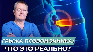 ВСЯ ПРАВДА о грыже межпозвонковых дисков, и как вас разводят медики ВСЯ ПРАВДА о грыже межпозвонковых дисков, и как вас разводят медики