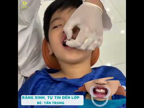 Video #niengrang #23 TỰ TIN DIỆN NỤ CƯỜI ĐẾN LỚP - youtube
