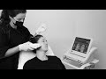 How does it work ultherapy treatment on the face  uma clinic amsterdam