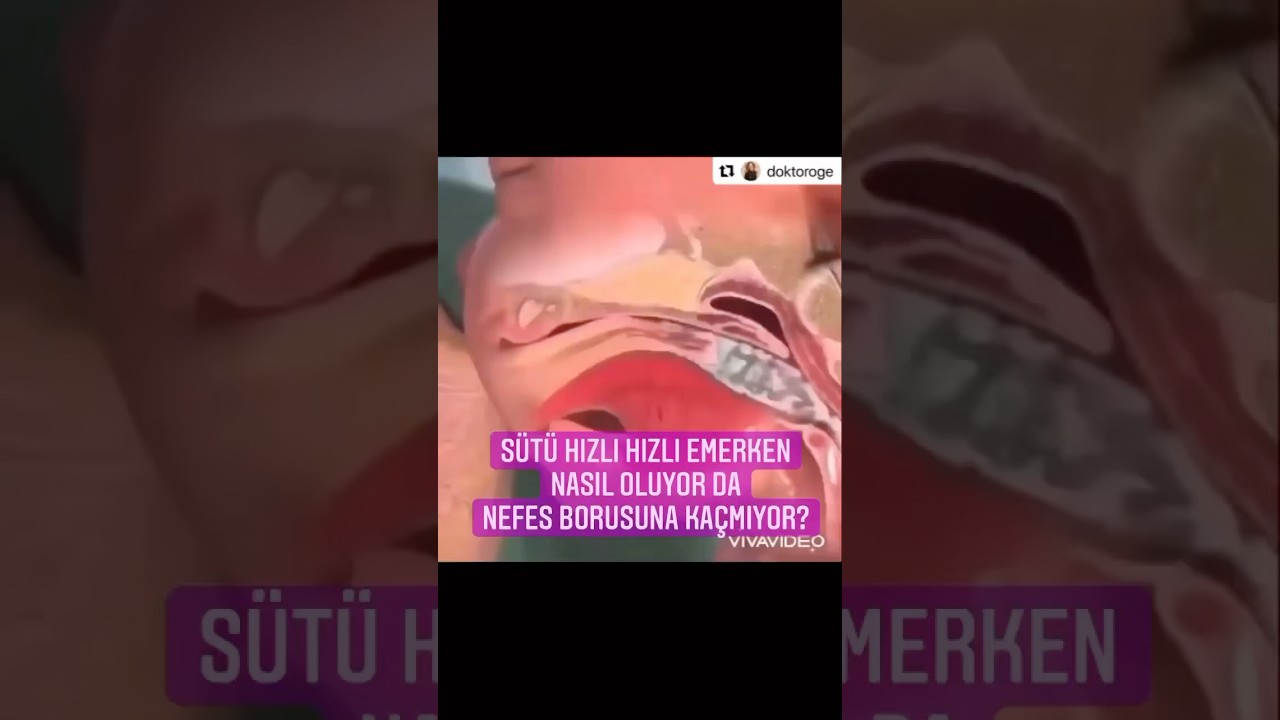 ⚠️Bebeğiniz sütü boğazına kaçırmadan nasıl içiyor! #doktoroge