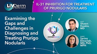 Examining the Gaps and Challenges in Diagnosing and Treating Prurigo Nodularis - Episode 1