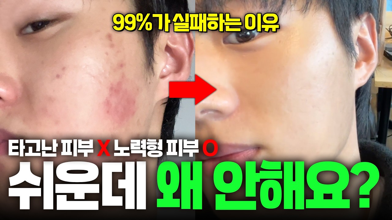 광고❌ 돈 안들이고 피부 좋아지는💸 고쳐야 할 습관 5가지
