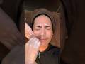 ワックス脱毛4回目行ってきた#髭ワックス脱毛 #waxing #ソロ氏
