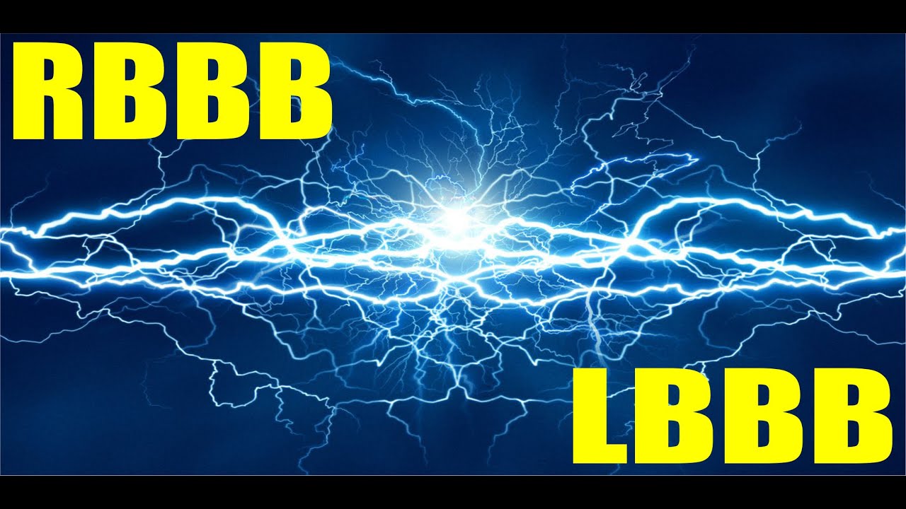 RBBB & LBBB: Bundle Branch Block Basics