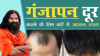 गंजापन दूर करने के लिए करें ये आसान उपाय || Swami Ramdev