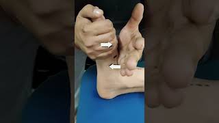 MOBILIZATION THERAPY FOR FLAT FOOT / MEDIAL ARCH PAIN.