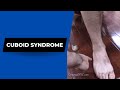 Cuboid syndrome lockjaw bicep tendon dislocation helped dr suh specific chiropractic nyc