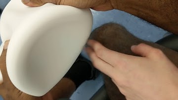 How to best put on your above knee pin lock liner to maximize comfort
