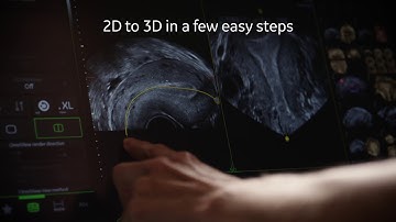 Voluson SWIFT - Easy 3D - This is Simplicity
