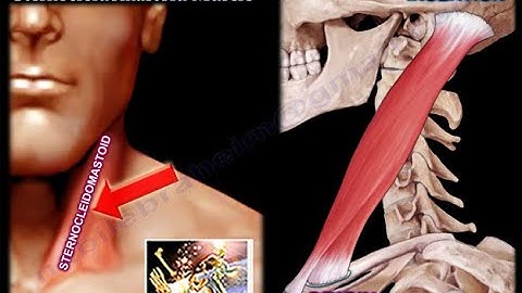 Anatomy Of The Sternocleidomastoid Muscle - Everything You Need To Know - Dr. Nabil Ebraheim
