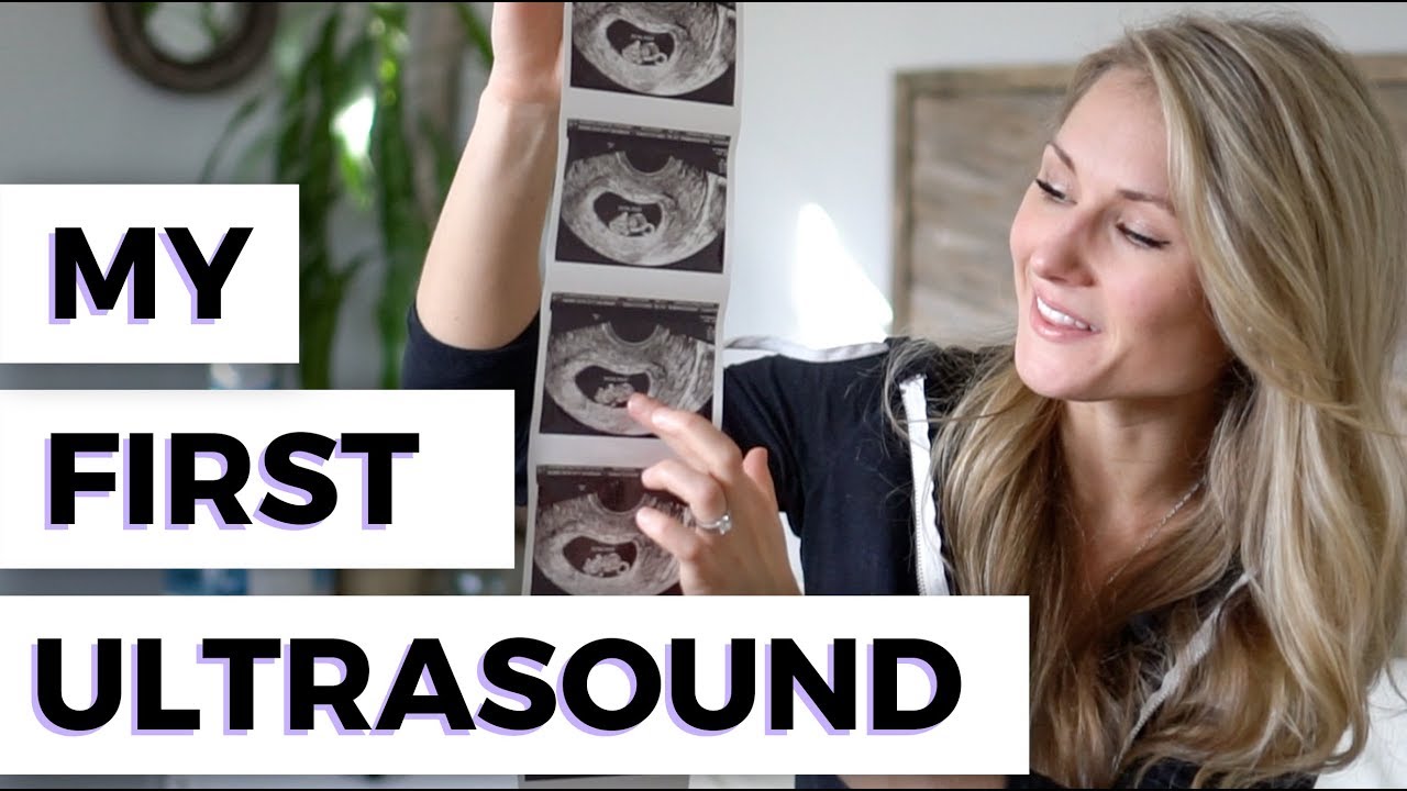 Our FIRST ULTRASOUND 8 Weeks Pregnant // Our first look at the baby for ...