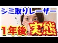 【大暴露】シミ取りレーザーから1年後の実態を全てお話しします