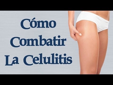 celulitis en la panza Como Combatir la Celulitis - 5 Consejos Simples para Combatir la Celulitis