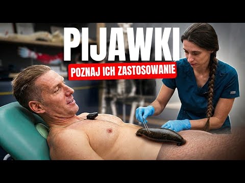 Postawiła mi PIJAWKI - na co one pomogą ?