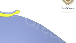 Clitoris Protrusion  Clitoris Correction By Prof Gress