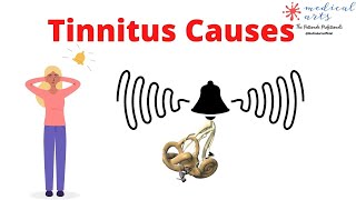 What Is Tinnitus: Causes, Diagnosis And Treatments - Ear Ringing.