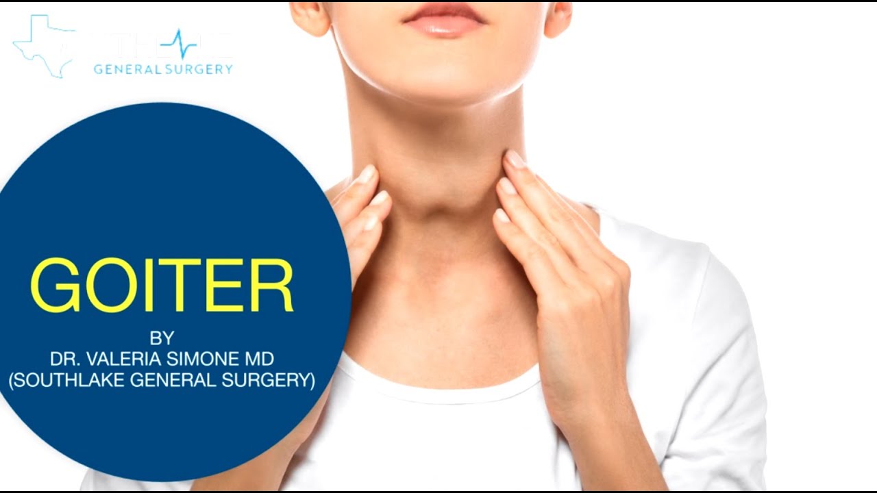 Goiter Causes Symptoms Treatment And Surgery YouTube