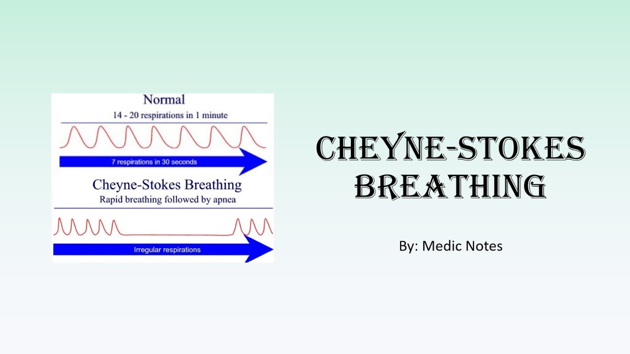Cheyne Stokes Breathing Causes Pathophysiology In Congestive Heart Cheyne Stokes Breathing Causes Pathophysiology In Congestive Heart