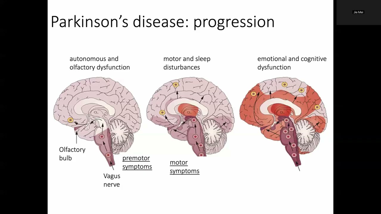 Visiting Lecture: Olfactory Changes & Early Detection of Neurodegenerative Disorders