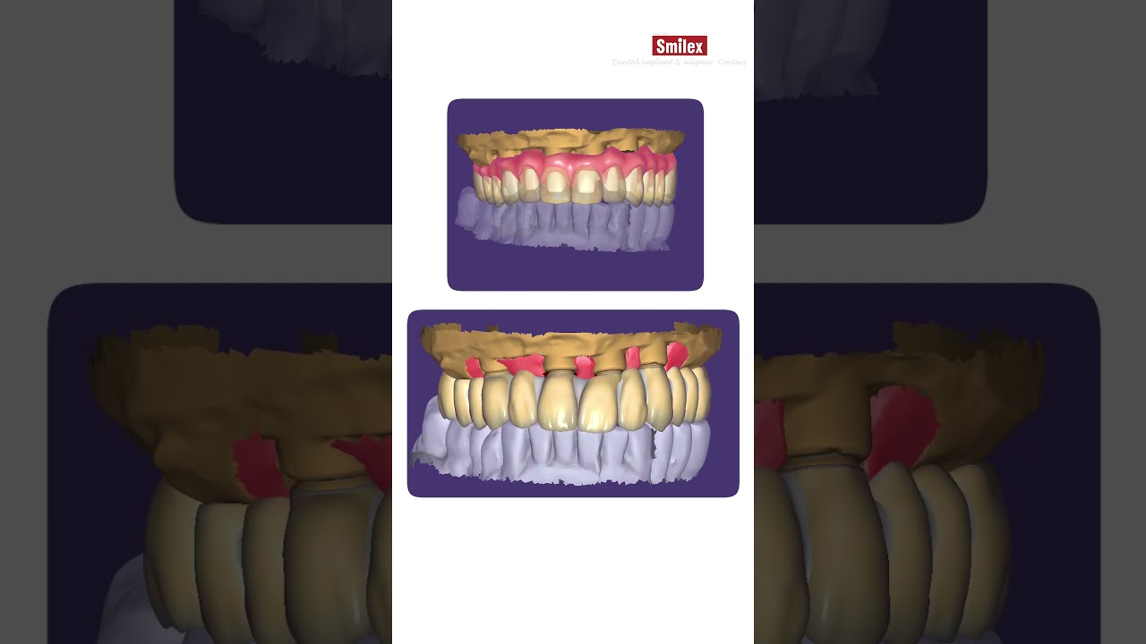 Digital Dentistry Transforms Smiles at Smilex  