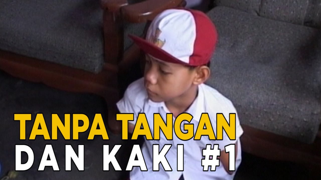 Anakku lahir tanpa tangan dan kaki | KEJAMNYA DUNIA