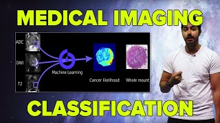 AI in Medicine |  Medical Imaging Classification (TensorFlow Tutorial)