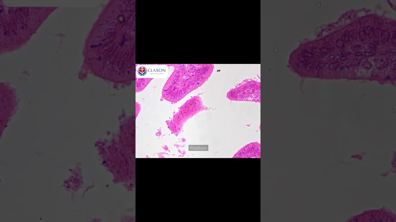 🌸 The Reproductive System Explained in 60 Seconds!