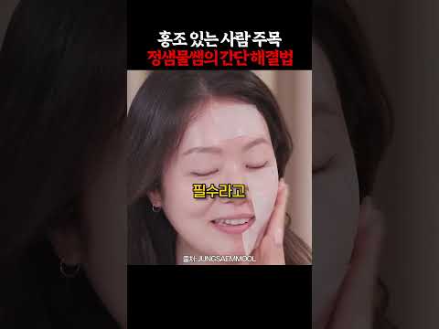 정샘물, 얼룩덜룩 홍조 싹 가려주는 비결? thumbnail