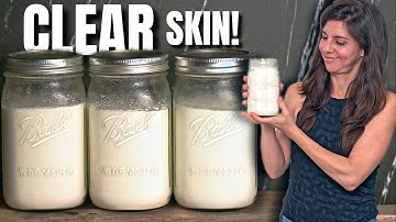 Deze yoghurt veranderde mijn leven, SIBO, Rosacea