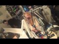 Capture de la vidéo The Brits 2010 - Ke$Ha Interview