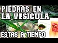 PIEDRAS en la  VESICULA , MUCHAS  cosas que no SABIAS , la MEJOR infusion para ELIMINARLOS