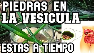 PIEDRAS en la  VESICULA , MUCHAS  cosas que no SABIAS , la MEJOR infusion para ELIMINARLOS