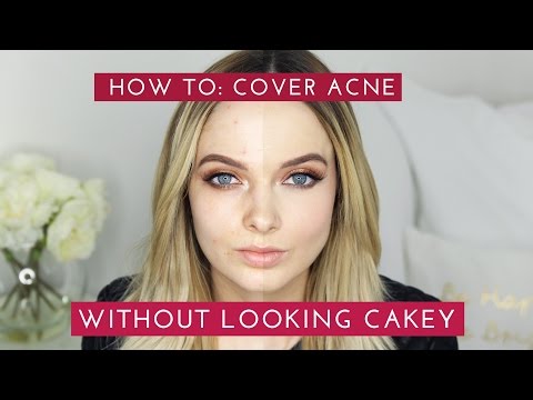 HOW TO: COVER ACNE & SCARS WITHOUT LOOKING CAKEY // MyPaleSkin