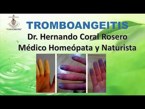 Vídeo: ¿Por Qué Los Vasos De Los Dedos Revientan Y Aparecen Hematomas, Cómo Tratar?