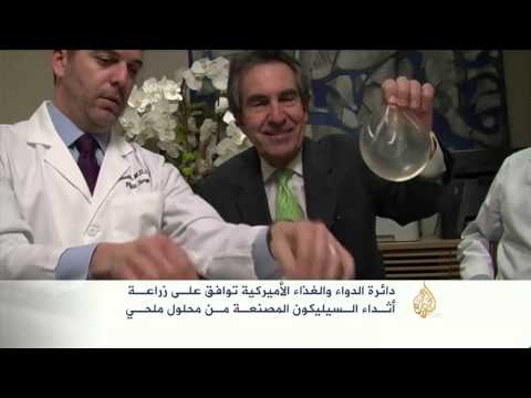 إنتاج أثداء سيليكون مصنعة من محلول ملحي