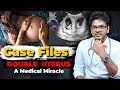 Case files ep4  the woman with an extra uterus  dr anuj pachhel