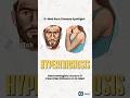 Hypertrichosis Explained: The Rare "Werewolf Syndrome" | G-Med Rare Disease Spotlight
