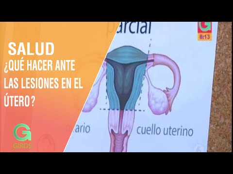lesiones en el cuello uterino consecuencias lesiones en el cuello uterino consecuencias