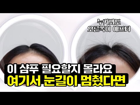 [GS홈쇼핑] 쓰고 안 쓰고가 이렇게 다른데 왜 안 써요? | 닥터포헤어 폴리젠 플러스 샴푸 두피샴푸, 탈모샴푸, 머릿결, 비듬, 볼륨