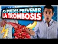 ☠️⚠️11 Alimentos que podrían ayudar a *PREVENIR* la formación de TROMBOS o COÁGULOS 🍉[No los obvies]