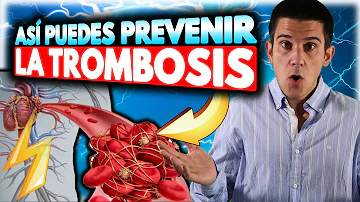 ¿Qué alimentos provocan trombosis venosa profunda?