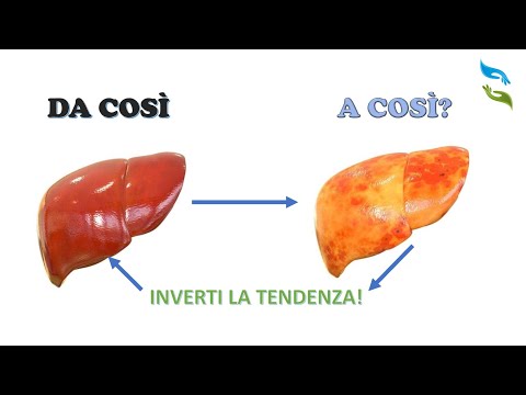 Video: Il fegato grasso mi ucciderà?