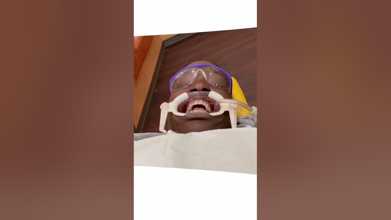 Putting in Braces in Jamaica YouTube